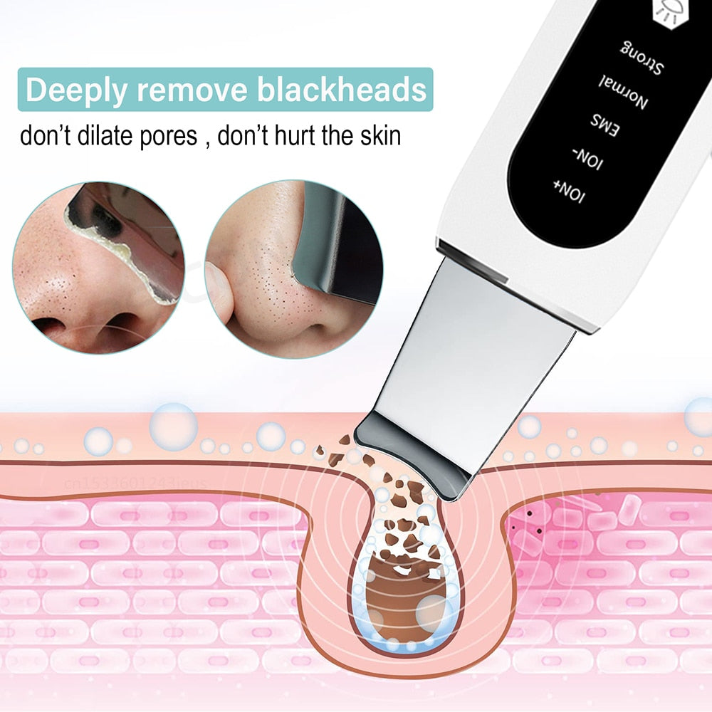 Deep Face Cleaning Ultrasonic Ion Acne Pore Cleaner Facial Shovel Cleanser